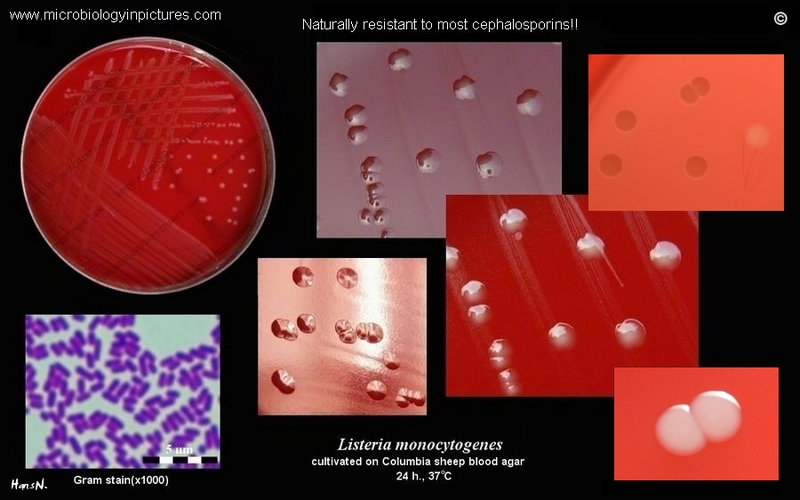 Listeria monocytogenes on agar plate